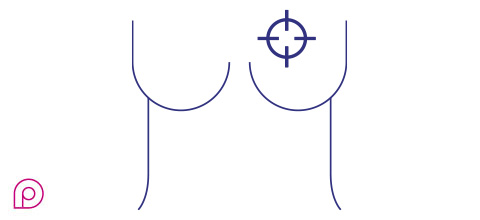 Mammografia