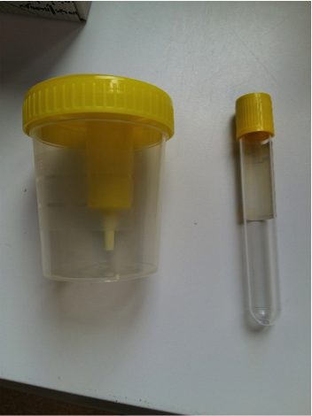 Contenitore urina con provetta