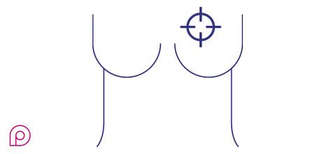 Mammografia